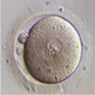 細胞質内に核が2つ見えている、正常受精の受精卵